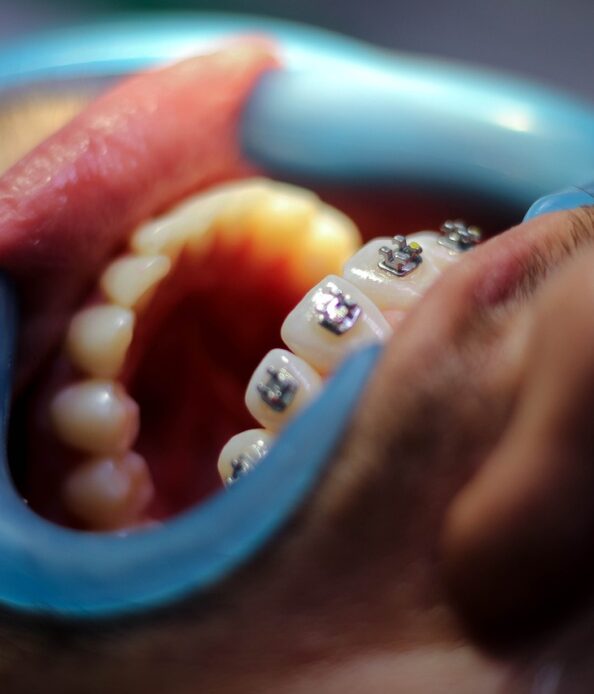 Ortodoncja Ząbki, dentysta, stomatolog